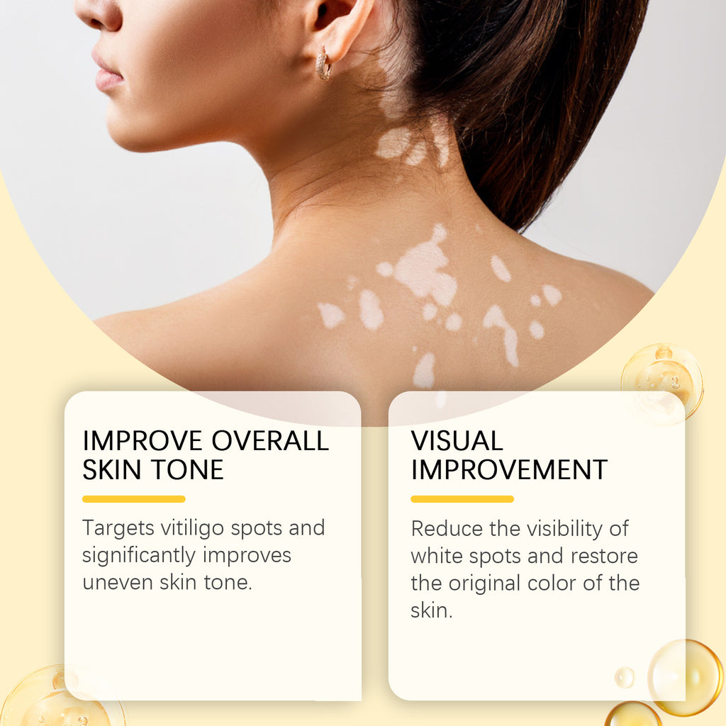 Bee White Spot Neck Cream – Brightening Skin Repair