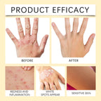 Bee White Spot Neck Cream Skin Repair - WelloriaShop