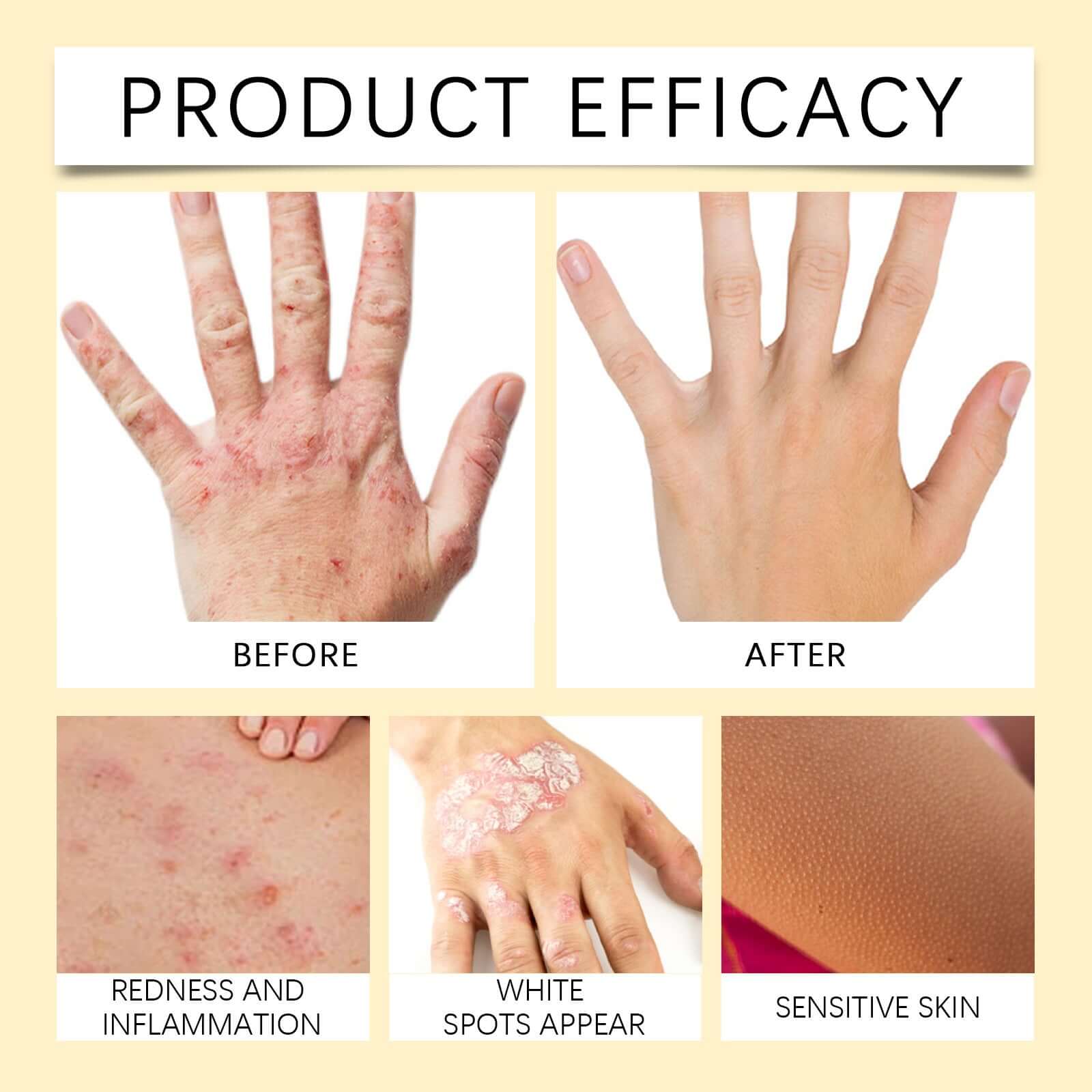 Bee White Spot Neck Cream Skin Repair - WelloriaShop
